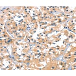 Immunohistochemistry - SLC6A4 Antibody from Signalway Antibody (37406) - Antibodies.com