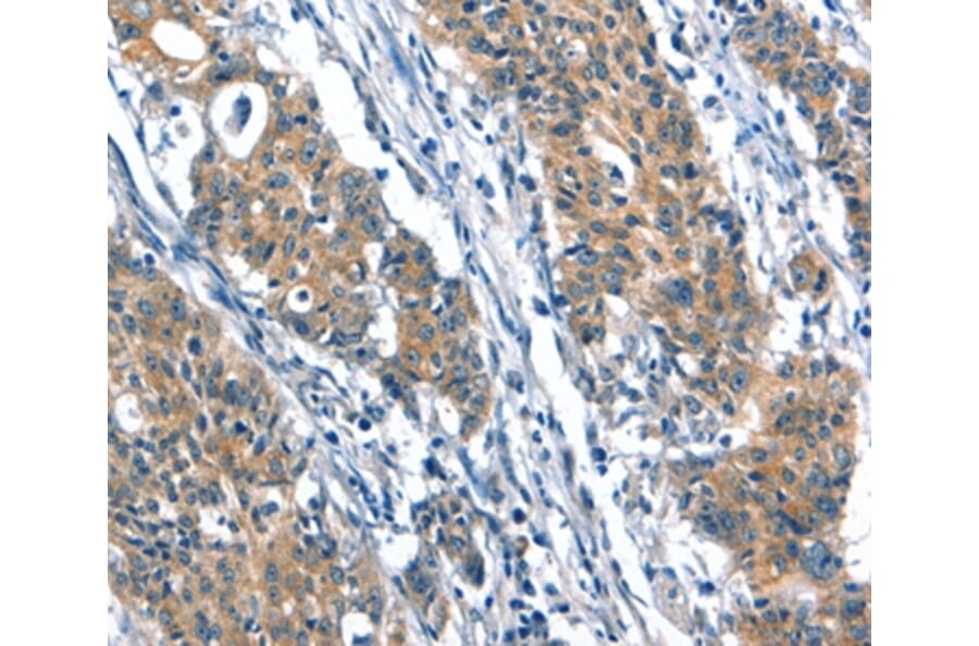 Immunohistochemistry - A4GALT Antibody from Signalway Antibody (37407) - Antibodies.com
