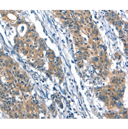 Immunohistochemistry - A4GALT Antibody from Signalway Antibody (37407) - Antibodies.com