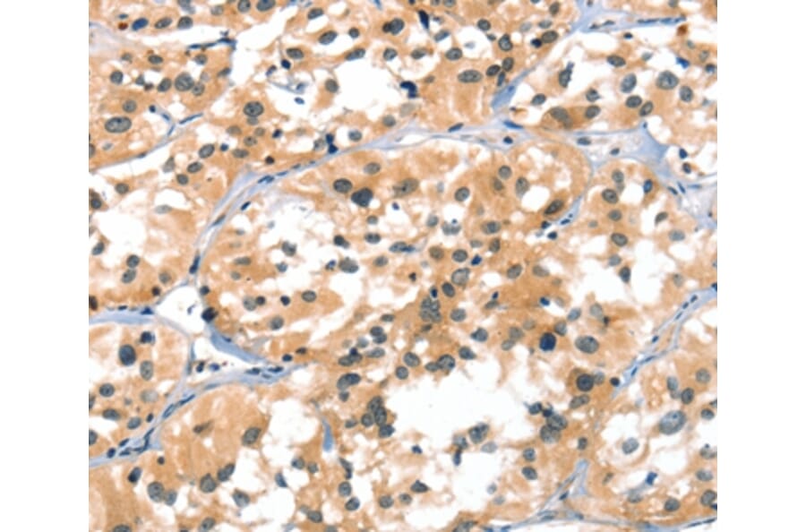Immunohistochemistry - A4GALT Antibody from Signalway Antibody (37407) - Antibodies.com