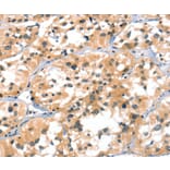 Immunohistochemistry - A4GALT Antibody from Signalway Antibody (37407) - Antibodies.com