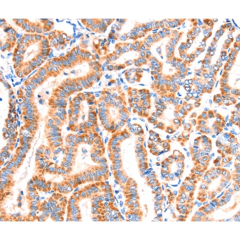 Immunohistochemistry - SCNN1A Antibody from Signalway Antibody (37412) - Antibodies.com