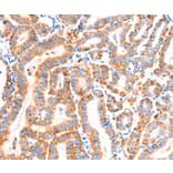 Immunohistochemistry - SCNN1A Antibody from Signalway Antibody (37412) - Antibodies.com