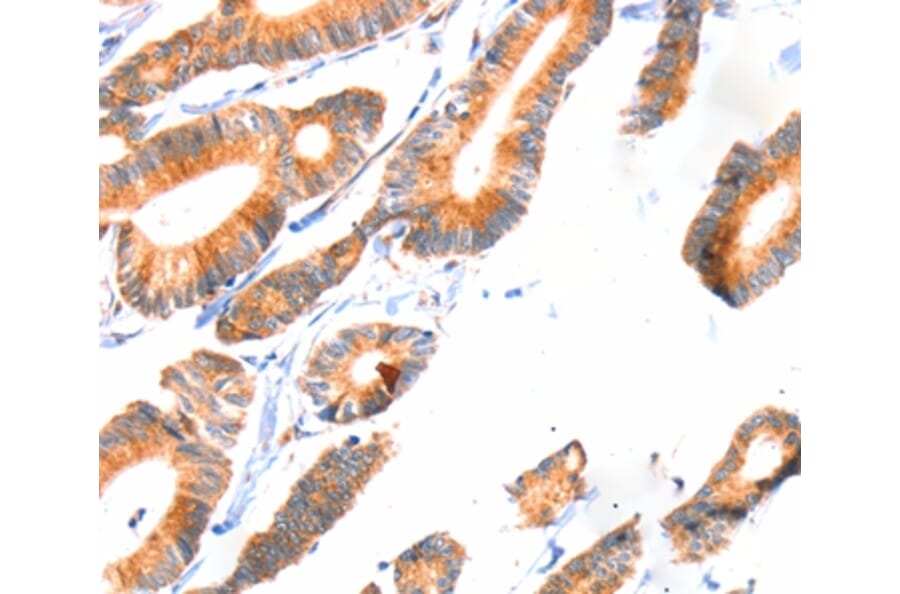 Immunohistochemistry - SCNN1A Antibody from Signalway Antibody (37412) - Antibodies.com