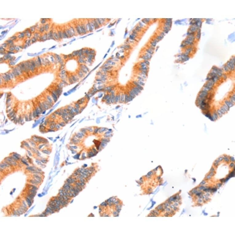 Immunohistochemistry - SCNN1A Antibody from Signalway Antibody (37412) - Antibodies.com