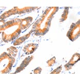 Immunohistochemistry - SCNN1A Antibody from Signalway Antibody (37412) - Antibodies.com