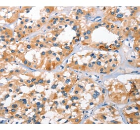 Immunohistochemistry - BNIP3L Antibody from Signalway Antibody (37422) - Antibodies.com