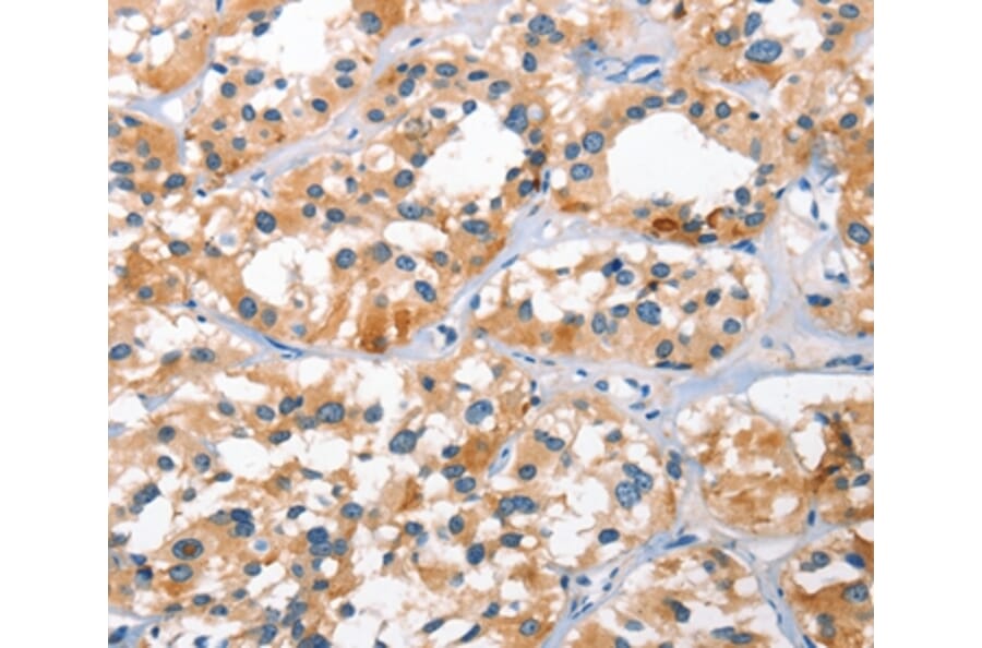 Immunohistochemistry - BNIP3L Antibody from Signalway Antibody (37422) - Antibodies.com