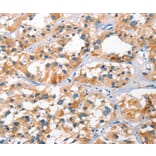 Immunohistochemistry - BNIP3L Antibody from Signalway Antibody (37422) - Antibodies.com