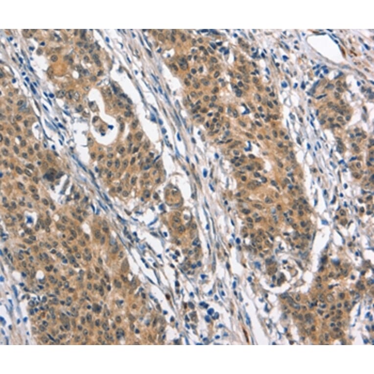 Immunohistochemistry - BNIP3L Antibody from Signalway Antibody (37422) - Antibodies.com