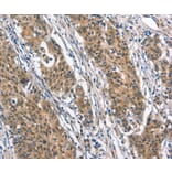 Immunohistochemistry - BNIP3L Antibody from Signalway Antibody (37422) - Antibodies.com