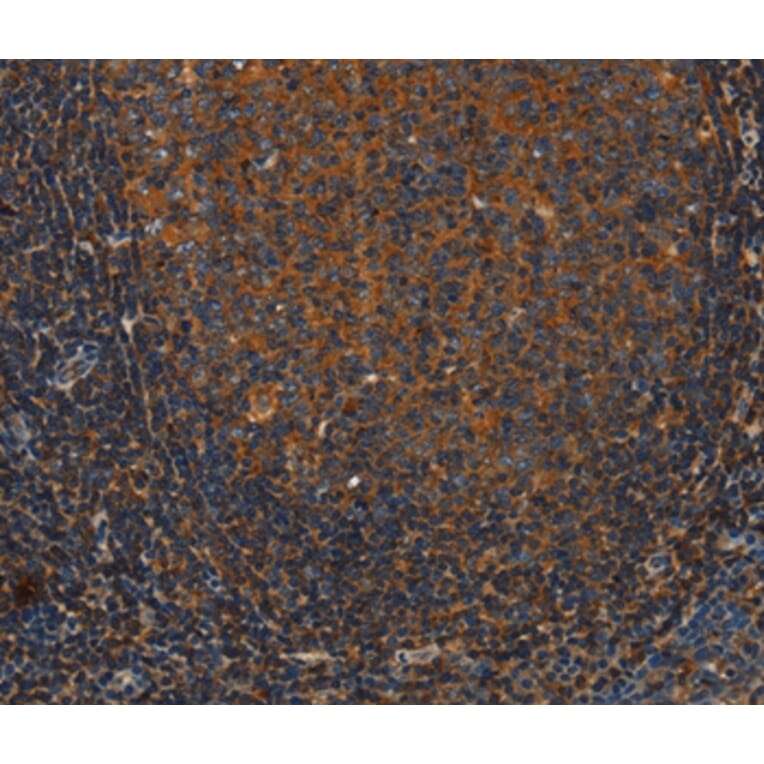 Immunohistochemistry - ANXA2R Antibody from Signalway Antibody (37434) - Antibodies.com