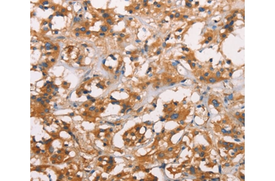 Immunohistochemistry - ANXA2R Antibody from Signalway Antibody (37434) - Antibodies.com