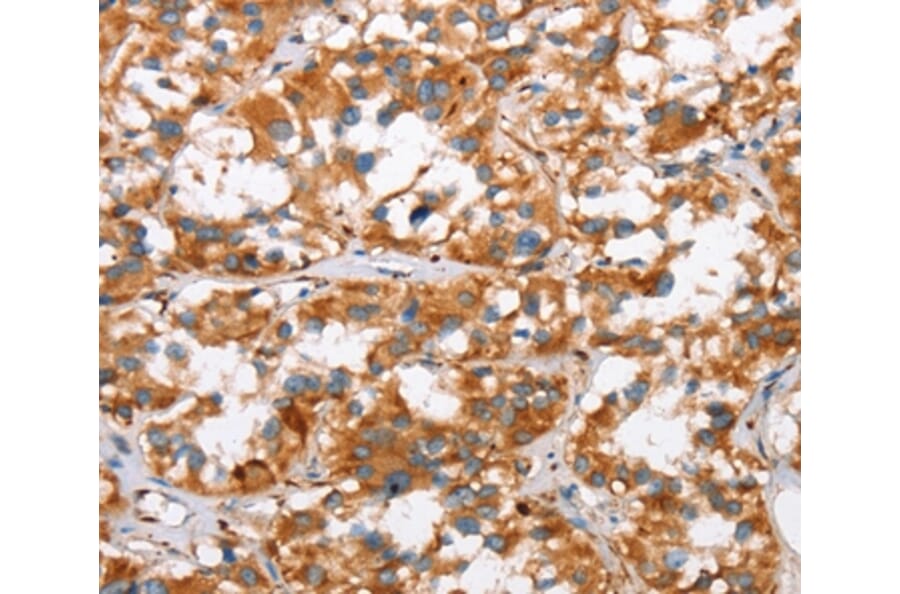 Immunohistochemistry - SLC4A1 Antibody from Signalway Antibody (37439) - Antibodies.com