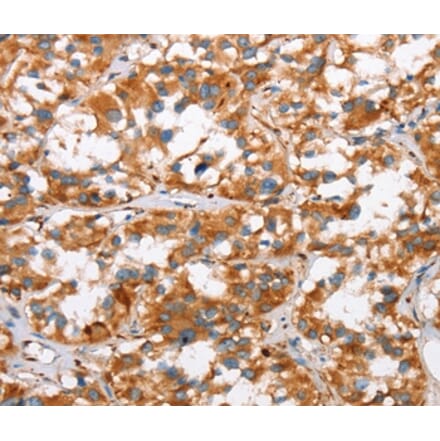 Immunohistochemistry - SLC4A1 Antibody from Signalway Antibody (37439) - Antibodies.com