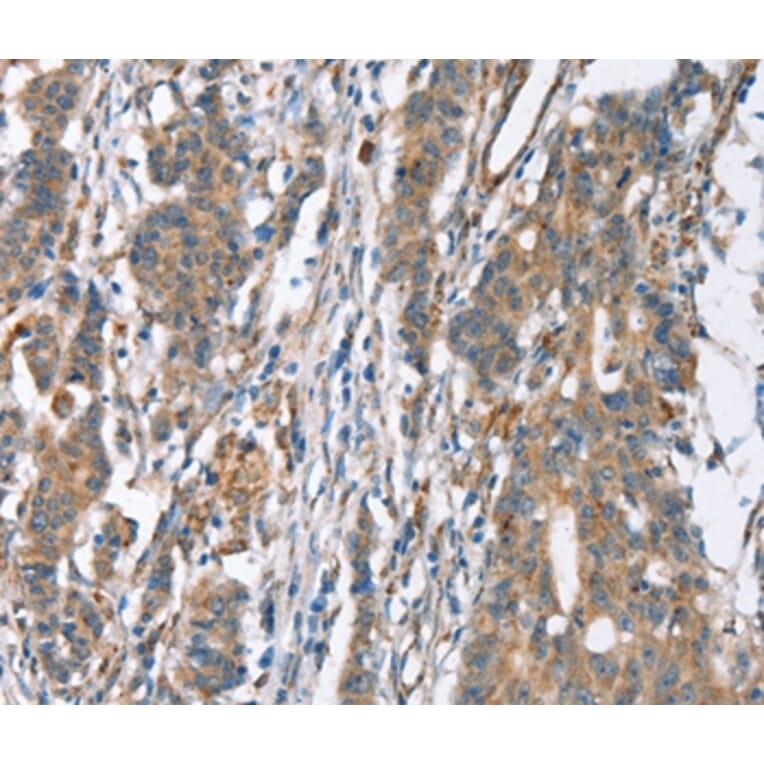 Immunohistochemistry - SLC4A1 Antibody from Signalway Antibody (37439) - Antibodies.com