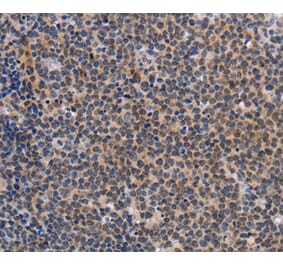 Immunohistochemistry - POU4F1 Antibody from Signalway Antibody (37447) - Antibodies.com