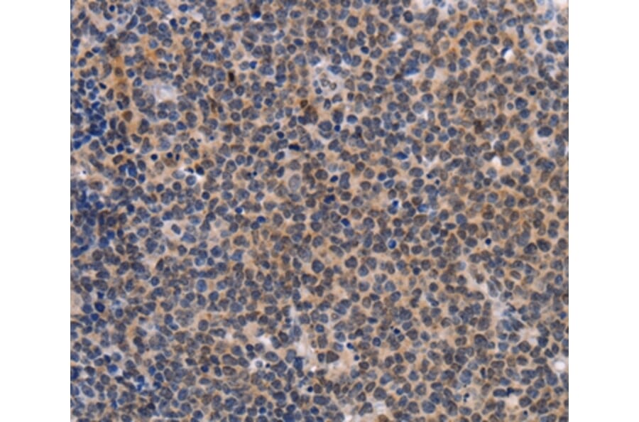 Immunohistochemistry - POU4F1 Antibody from Signalway Antibody (37447) - Antibodies.com