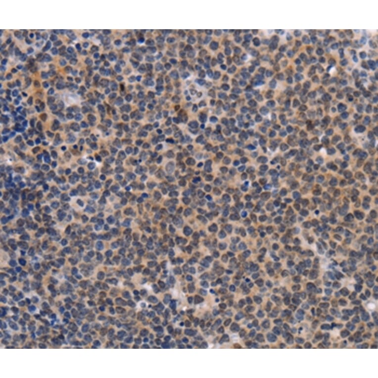 Immunohistochemistry - POU4F1 Antibody from Signalway Antibody (37447) - Antibodies.com