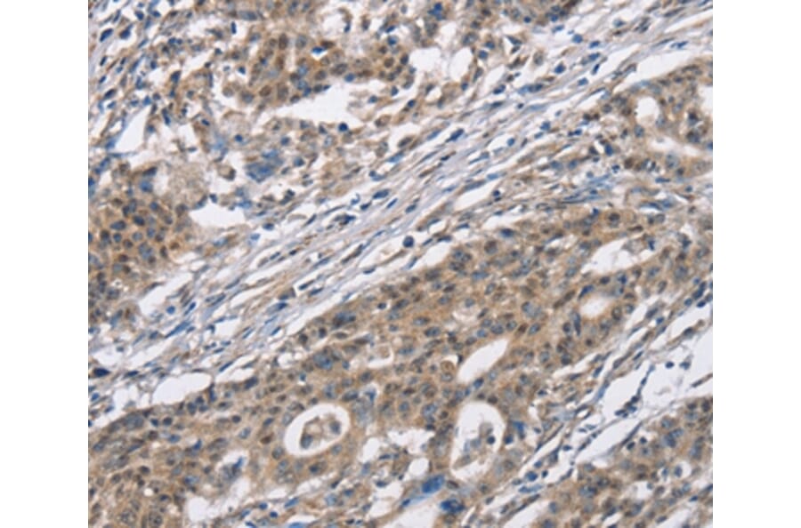Immunohistochemistry - CACNA1 Antibody from Signalway Antibody (37452) - Antibodies.com