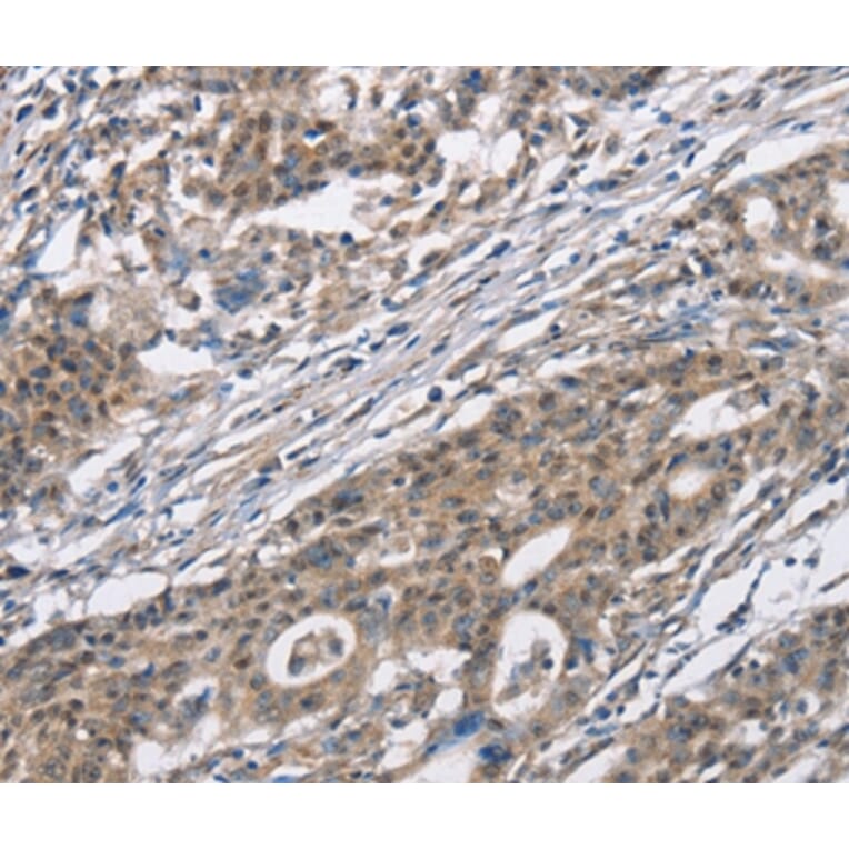 Immunohistochemistry - CACNA1 Antibody from Signalway Antibody (37452) - Antibodies.com