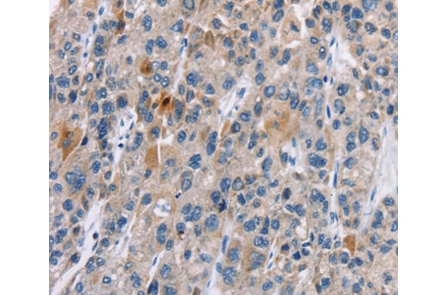 Immunohistochemistry - CACNA1 Antibody from Signalway Antibody (37452) - Antibodies.com