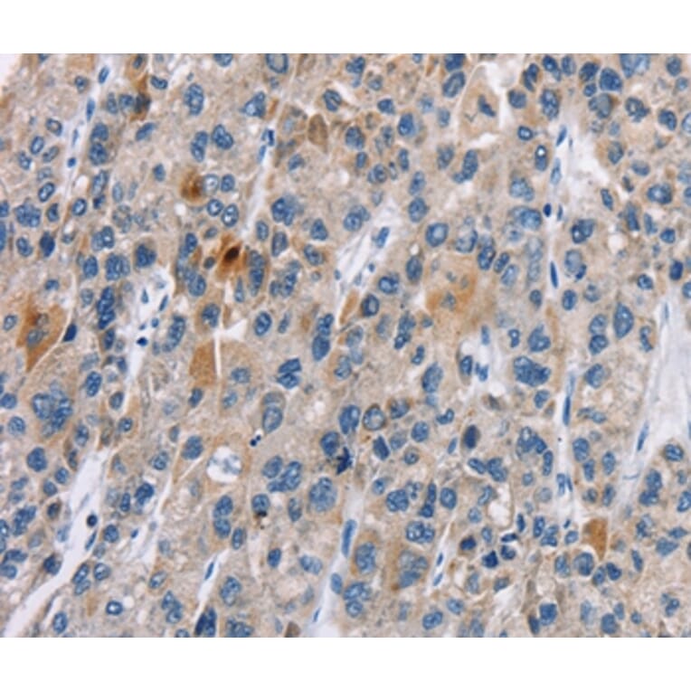 Immunohistochemistry - CACNA1 Antibody from Signalway Antibody (37452) - Antibodies.com