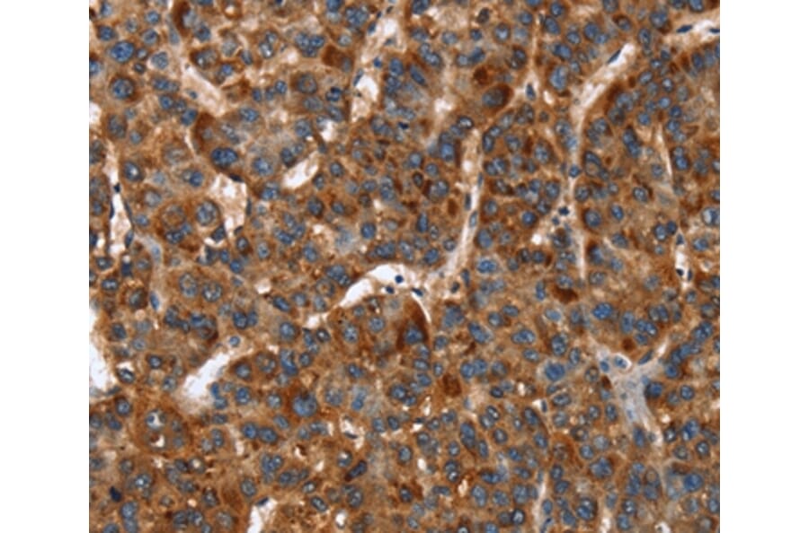 Immunohistochemistry - CACNB2 Antibody from Signalway Antibody (37456) - Antibodies.com