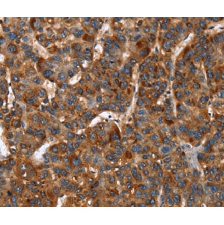 Immunohistochemistry - CACNB2 Antibody from Signalway Antibody (37456) - Antibodies.com