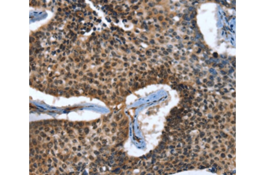 Immunohistochemistry - CACNB2 Antibody from Signalway Antibody (37456) - Antibodies.com