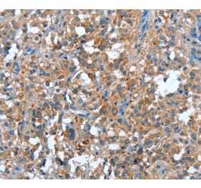 Immunohistochemistry - PLA2G6 Antibody from Signalway Antibody (37457) - Antibodies.com