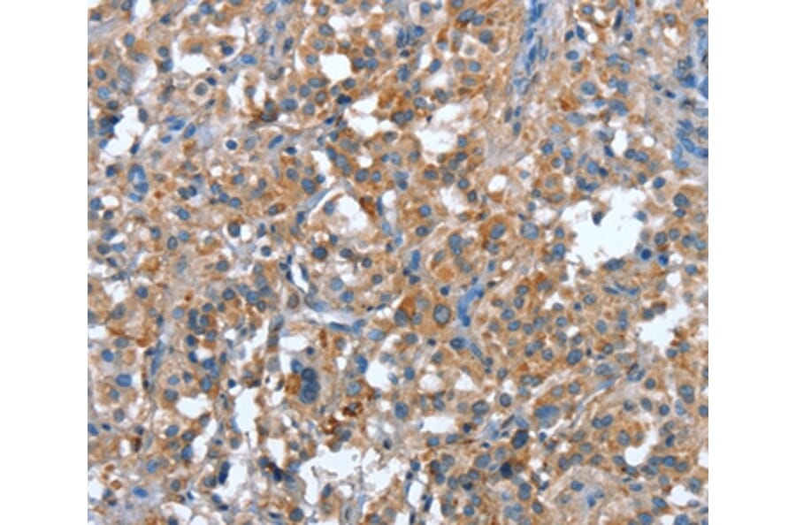 Immunohistochemistry - PLA2G6 Antibody from Signalway Antibody (37457) - Antibodies.com