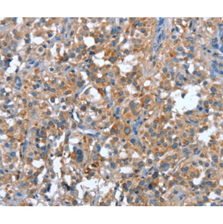 Immunohistochemistry - PLA2G6 Antibody from Signalway Antibody (37457) - Antibodies.com