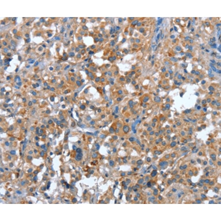 Immunohistochemistry - PLA2G6 Antibody from Signalway Antibody (37457) - Antibodies.com