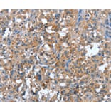 Immunohistochemistry - PLA2G6 Antibody from Signalway Antibody (37457) - Antibodies.com