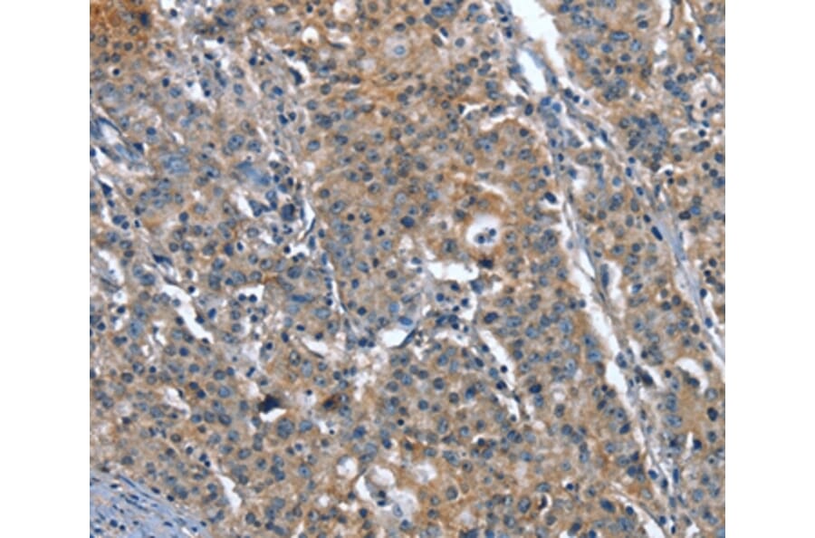 Immunohistochemistry - PLA2G6 Antibody from Signalway Antibody (37457) - Antibodies.com