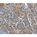 Immunohistochemistry - PLA2G6 Antibody from Signalway Antibody (37457) - Antibodies.com