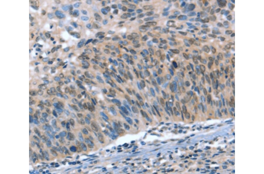 Immunohistochemistry - CAMTA1 Antibody from Signalway Antibody (37458) - Antibodies.com