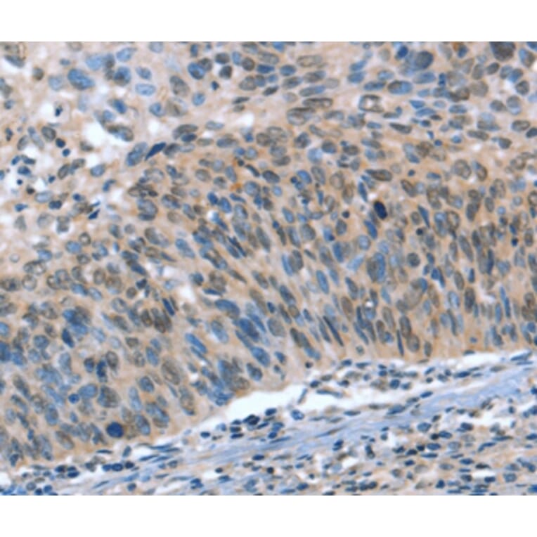 Immunohistochemistry - CAMTA1 Antibody from Signalway Antibody (37458) - Antibodies.com