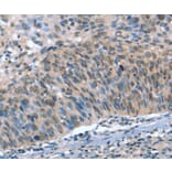 Immunohistochemistry - CAMTA1 Antibody from Signalway Antibody (37458) - Antibodies.com