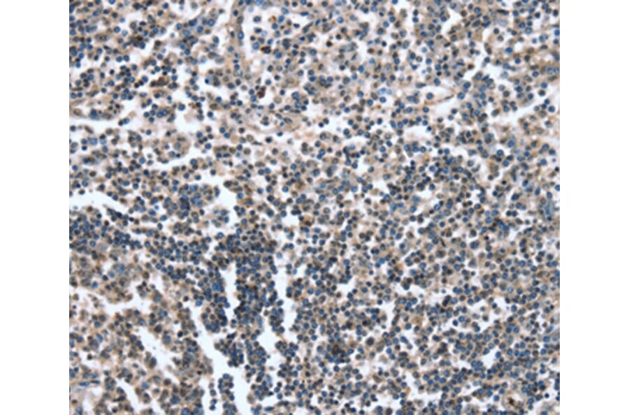 Immunohistochemistry - CAMTA1 Antibody from Signalway Antibody (37458) - Antibodies.com