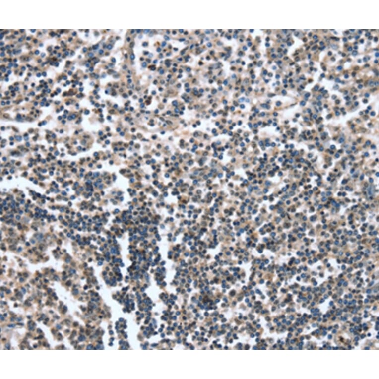 Immunohistochemistry - CAMTA1 Antibody from Signalway Antibody (37458) - Antibodies.com