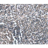 Immunohistochemistry - CAMTA1 Antibody from Signalway Antibody (37458) - Antibodies.com