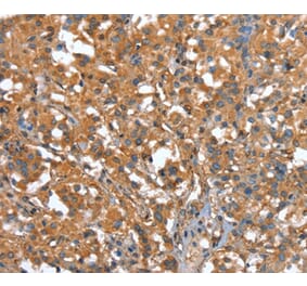 Immunohistochemistry - CAPZA1 Antibody from Signalway Antibody (37459) - Antibodies.com