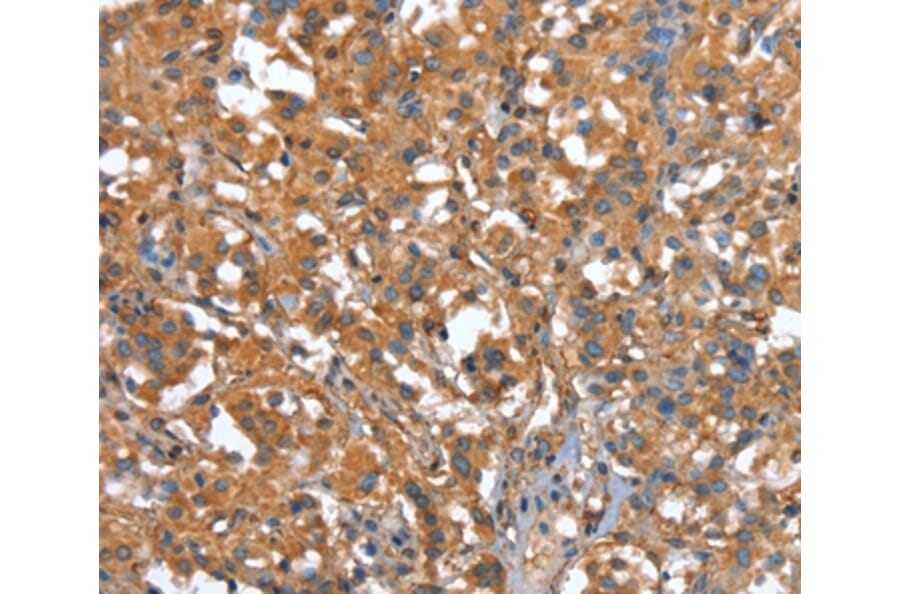 Immunohistochemistry - CAPZA1 Antibody from Signalway Antibody (37459) - Antibodies.com