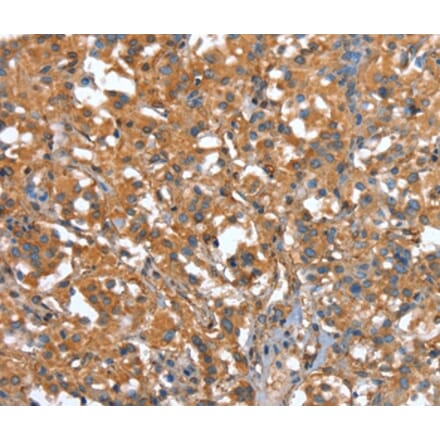 Immunohistochemistry - CAPZA1 Antibody from Signalway Antibody (37459) - Antibodies.com