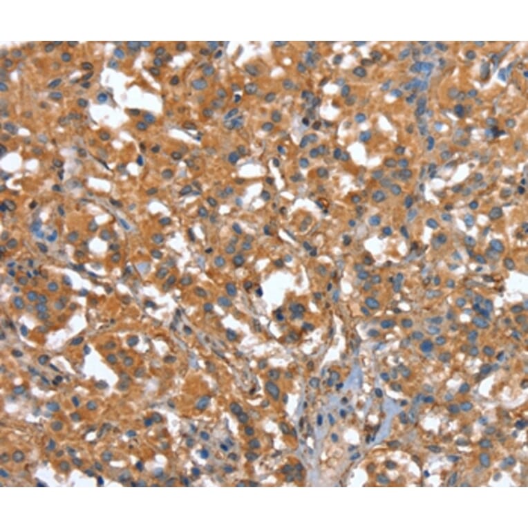 Immunohistochemistry - CAPZA1 Antibody from Signalway Antibody (37459) - Antibodies.com