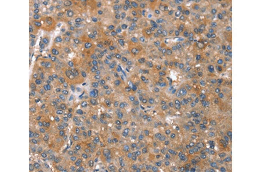 Immunohistochemistry - CAPZA1 Antibody from Signalway Antibody (37459) - Antibodies.com