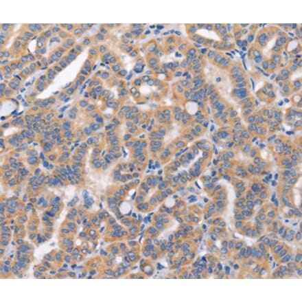 Immunohistochemistry - CARD17 Antibody from Signalway Antibody (37461) - Antibodies.com