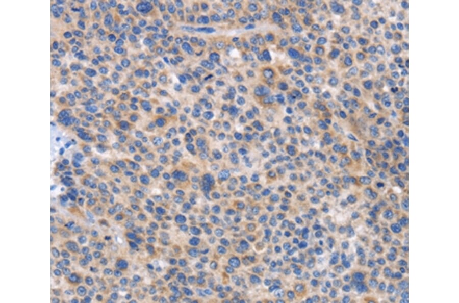 Immunohistochemistry - CARD17 Antibody from Signalway Antibody (37461) - Antibodies.com